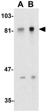 ADAM10 Antibody in Western Blot (WB)