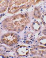 BNIP3L Antibody in Immunohistochemistry (Paraffin) (IHC (P))