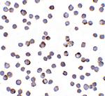 RAIDD Antibody in Immunocytochemistry (ICC/IF)