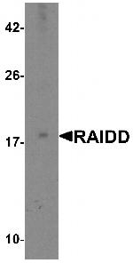 RAIDD Antibody in Western Blot (WB)