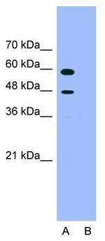 PDCD4 Antibody in Western Blot (WB)