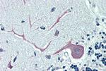 ORP1 Antibody in Immunohistochemistry (Paraffin) (IHC (P))