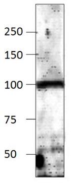 Adenylate Cyclase 9 Antibody in Western Blot (WB)