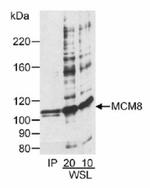 MCM8 Antibody in Western Blot (WB)