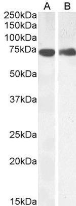 COX1 Antibody in Western Blot (WB)