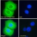 PLK4 Antibody in Immunocytochemistry (ICC/IF)