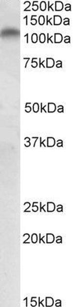 PLK4 Antibody in Western Blot (WB)