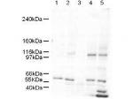 SMARCAL1 Antibody in Western Blot (WB)