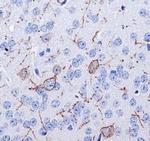 TACR1 Antibody in Immunohistochemistry (Paraffin) (IHC (P))