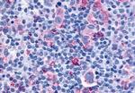 CYSLTR1 Antibody in Immunohistochemistry (Paraffin) (IHC (P))
