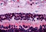 MTNR1B Antibody in Immunohistochemistry (Paraffin) (IHC (P))