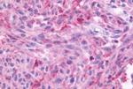 NMBR Antibody in Immunohistochemistry (Paraffin) (IHC (P))