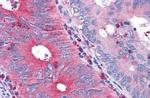 TAS1R1 Antibody in Immunohistochemistry (Paraffin) (IHC (P))