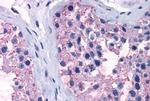 TAS1R1 Antibody in Immunohistochemistry (Paraffin) (IHC (P))