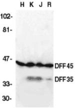 ICAD Antibody in Western Blot (WB)