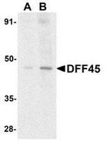 ICAD Antibody in Western Blot (WB)