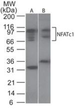 NFATC1 Antibody in Western Blot (WB)