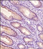 TAK1 Antibody in Immunohistochemistry (Paraffin) (IHC (P))