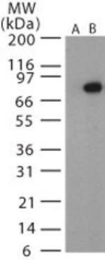 Anthrax Protective Antigen Antibody in Western Blot (WB)