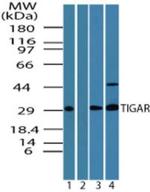 TIGAR Antibody in Western Blot (WB)
