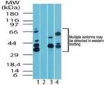 TNPO1 Antibody in Western Blot (WB)