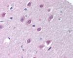 Importin 9 Antibody in Immunohistochemistry (Paraffin) (IHC (P))