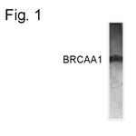 BRCAA1 Antibody in Western Blot (WB)
