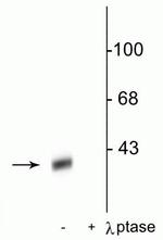 Phospho-DARPP-32 (Thr34) Antibody in Western Blot (WB)