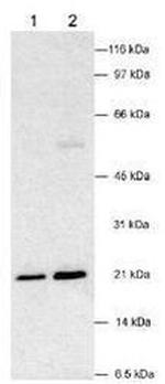 VHL Antibody in Western Blot (WB)