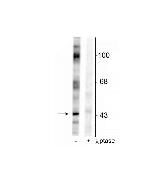 Phospho-EphB2 (Tyr317) Antibody in Western Blot (WB)