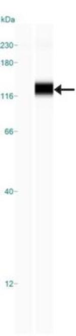 SCP1 Antibody in Western Blot (WB)