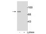 Phospho-MARCKS (Ser152, Ser156) Antibody in Western Blot (WB)