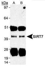 SIRT7 Antibody in Immunoprecipitation (IP)