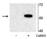 Phospho-TPH2 (Ser19) Antibody in Western Blot (WB)