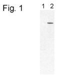 PDE6B Antibody in Western Blot (WB)