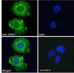 ARPC2 Antibody in Immunocytochemistry (ICC/IF)