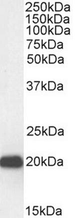 HP1 gamma Antibody in Western Blot (WB)