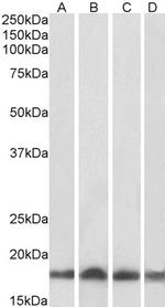 UBE2L3 Antibody in Western Blot (WB)