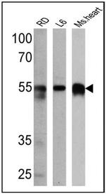 Calsequestrin Antibody in Western Blot (WB)
