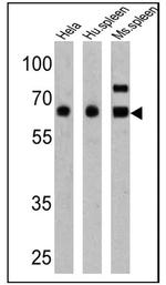 PKR Antibody in Western Blot (WB)