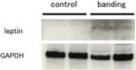 Leptin Antibody in Western Blot (WB)