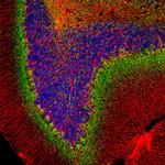 alpha Internexin Antibody in Immunocytochemistry (ICC/IF)