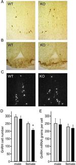 GnRH1 Antibody in Immunohistochemistry (IHC)