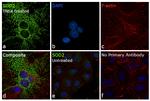 SOD2 Antibody in Immunocytochemistry (ICC/IF)