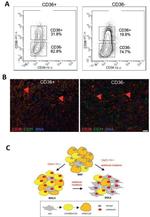 CD36 Antibody in Immunohistochemistry (IHC)