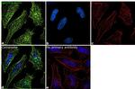 gamma Actin Antibody in Immunocytochemistry (ICC/IF)