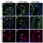 Versican V0, V1 Neo Antibody in Immunocytochemistry (ICC/IF)