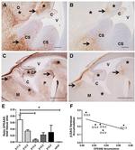 Versican V0, V1 Neo Antibody in Immunohistochemistry (IHC)