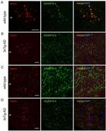 ADAMTS4 Antibody in Immunohistochemistry (IHC)