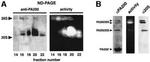 PSME4 Antibody in Western Blot (WB)